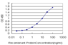 10 - SREBF1 Antibody (monoclonal) (M02) AT4036a