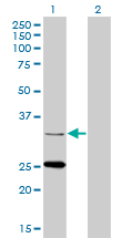 1 - STAR Antibody (monoclonal) (M01) AT4059a