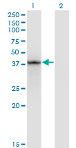 1 - STAT5B Antibody (monoclonal) (M01) AT4064a