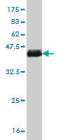 1 - STAT6 Antibody (monoclonal) (M01) AT4067a
