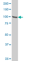 1 - STAT6 Antibody (monoclonal) (M01) AT4067a