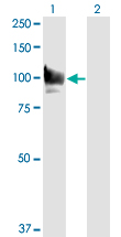 1 - STAT6 Antibody (monoclonal) (M01) AT4067a