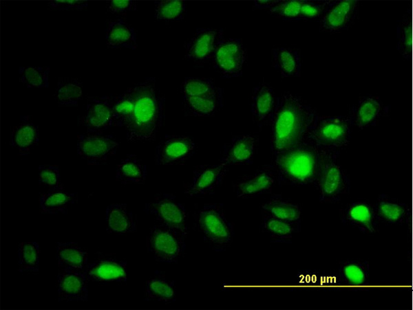 3 - STK6 Antibody (monoclonal) (M01) AT4091a