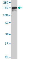 1 - SUPT5H Antibody (monoclonal) (M01) AT4108a