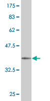 1 - SUPT5H Antibody (monoclonal) (M04) AT4110a