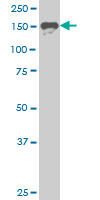 1 - SUPT5H Antibody (monoclonal) (M04) AT4110a