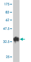 1 - TAF5L Antibody (monoclonal) (M01) AT4146a