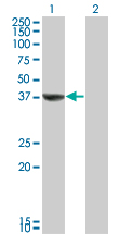 1 - TAF5L Antibody (monoclonal) (M01) AT4146a