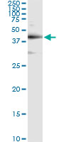 5 - TARDBP Antibody (monoclonal) (M01) AT4154a