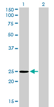 1 - THAP1 Antibody (monoclonal) (M01) AT4231a