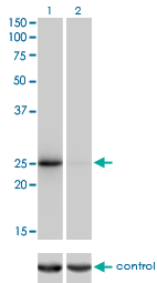 1 - THAP1 Antibody (monoclonal) (M01) AT4231a