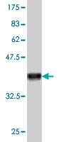 1 - THEA Antibody (monoclonal) (M01) AT4232a