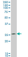 1 - THTPA Antibody (monoclonal) (M01) AT4236a