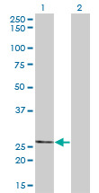 1 - THTPA Antibody (monoclonal) (M01) AT4236a