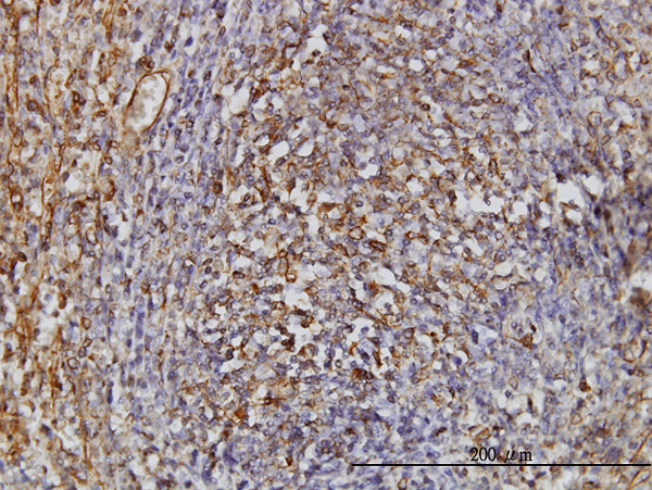 2 - TPMT Antibody (monoclonal) (M01) AT4320a