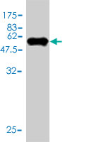 1 - TPMT Antibody (monoclonal) (M01) AT4320a