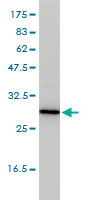 1 - TPMT Antibody (monoclonal) (M01) AT4320a
