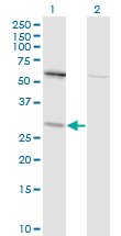 1 - TPMT Antibody (monoclonal) (M01) AT4320a
