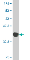 1 - TPO Antibody (monoclonal) (M08) AT4322a