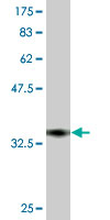 1 - TRPV5 Antibody (monoclonal) (M06) AT4372a