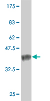 1 - TXNL6 Antibody (monoclonal) (M01) AT4421a