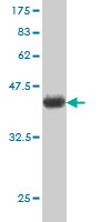 1 - UBE2C Antibody (monoclonal) (M01) AT4429a