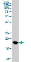 1 - UBE2C Antibody (monoclonal) (M01) AT4429a