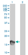 1 - UBE2C Antibody (monoclonal) (M01) AT4429a