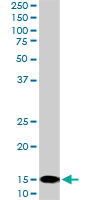 1 - UBE2D2 Antibody (monoclonal) (M02) AT4432a