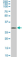 1 - UCP1 Antibody (monoclonal) (M03) AT4459a
