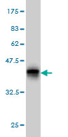 1 - UGT2B10 Antibody (monoclonal) (M01) AT4460a
