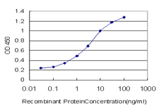 10 - UMPS Antibody (monoclonal) (M05) AT4467a