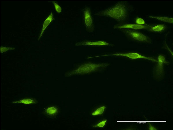 3 - VAPA Antibody (monoclonal) (M01) AT4501a