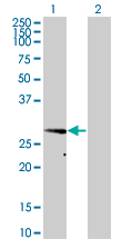 1 - VAPA Antibody (monoclonal) (M01) AT4501a