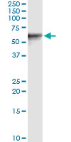 5 - VIM Antibody (monoclonal) (M01) AT4513a