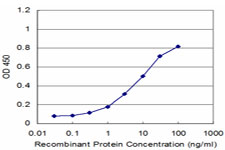 10 - WASF2 Antibody (monoclonal) (M01) AT4525a