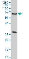 1 - WASF2 Antibody (monoclonal) (M01) AT4525a