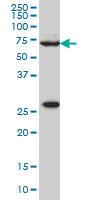 1 - WASF2 Antibody (monoclonal) (M02) AT4526a