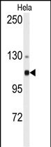 1 - ACTN4 Antibody (N-term) AP7790a