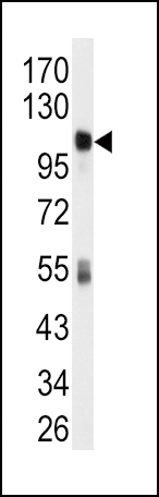 1 - ALDH1L1 Antibody (C-term) AP7848B