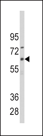 1 - CYP1B1 Antibody (Center) AP7891c