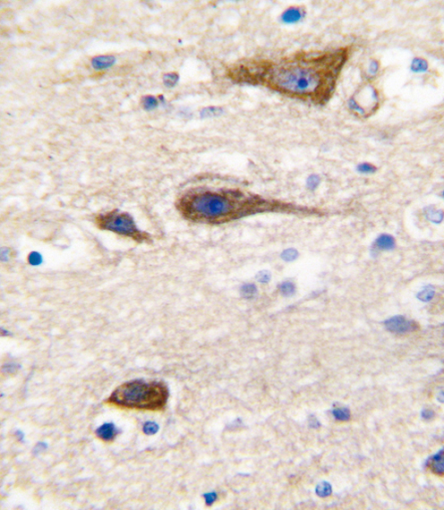 14 - CYP2R1 Antibody (Center) AP7894C
