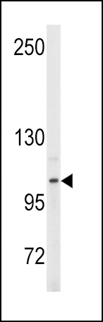 1 - ENPP2 Antibody (Center K416) AP2854C