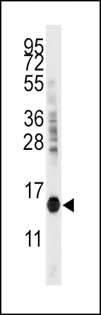 1 - CDA Antibody (C-term) AP2868b