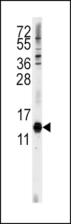 1 - CDA Antibody (C-term) AP2868b