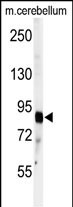 1 - ADAMTS4 Antibody (C-term) AP7439b