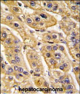 14 - HIBCH Antibody (Center) AP7435c