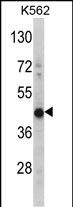 1 - HIBCH Antibody (Center) AP7435c