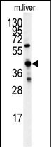 1 - GCAT Antibody (Center) AP7498c