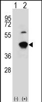 1 - GCAT Antibody (Center) AP7498c
